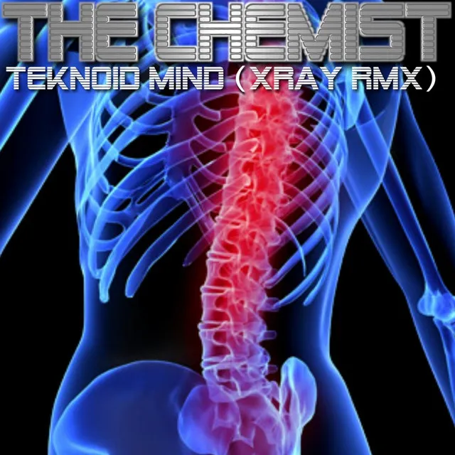 Teknoid Mind - Xray Rmx