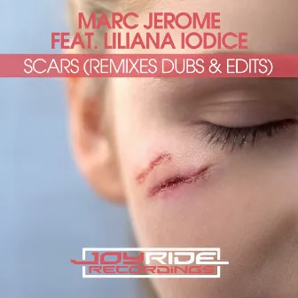 Scars (Remixes Dubs & Edits) by Marc Jerome