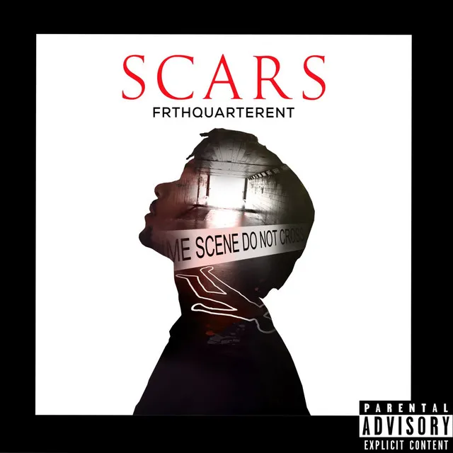 Scars