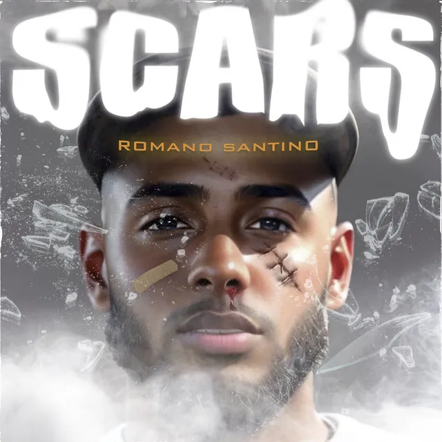 Scars