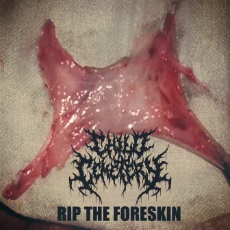 Rip the Foreskin by Child Cemetery