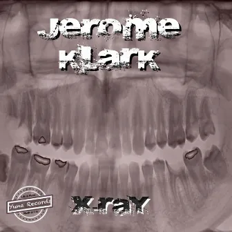 X-Ray by Jerome Klark