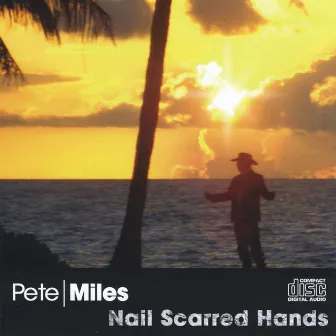 Nail Scarred Hands by Pete Miles