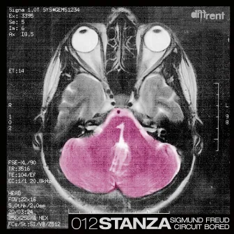 Sigmund Freud / Circuit Bored by Stanza