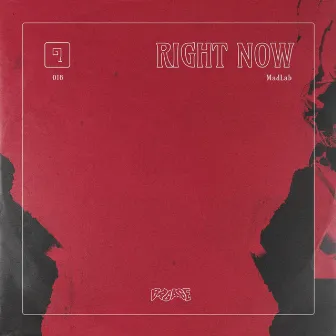 Right Now by Unknown Artist