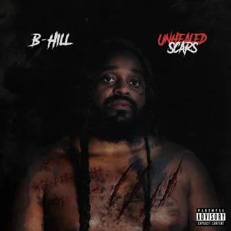 UNHEALED SCARS by B-Hill