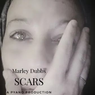 Scars (Radio Edit) by Marley Dubbs