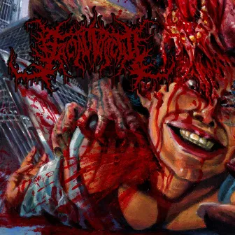 Carnivorous Myocardium Engorgement by Facial Fracture