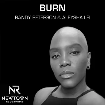 Burn by Randy Peterson