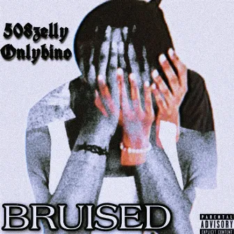 Bruised by Onlybino