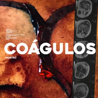 Coágulos by MΩSTRO