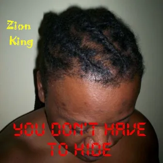 You Don't Have to Hide (Qsmd Studio Version) [feat. DJ Talon] by Zion King