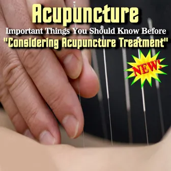 Important Things You Should Know Before Considering Acupuncture Treatment by Acupuncture